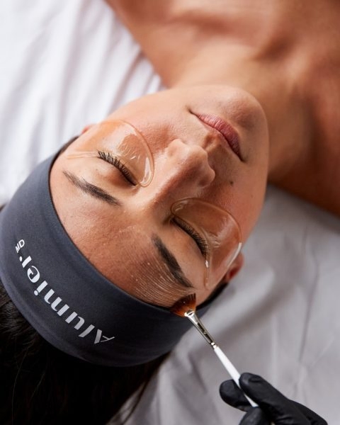 Medical-grade AlumierMD chemical peels in Burlington