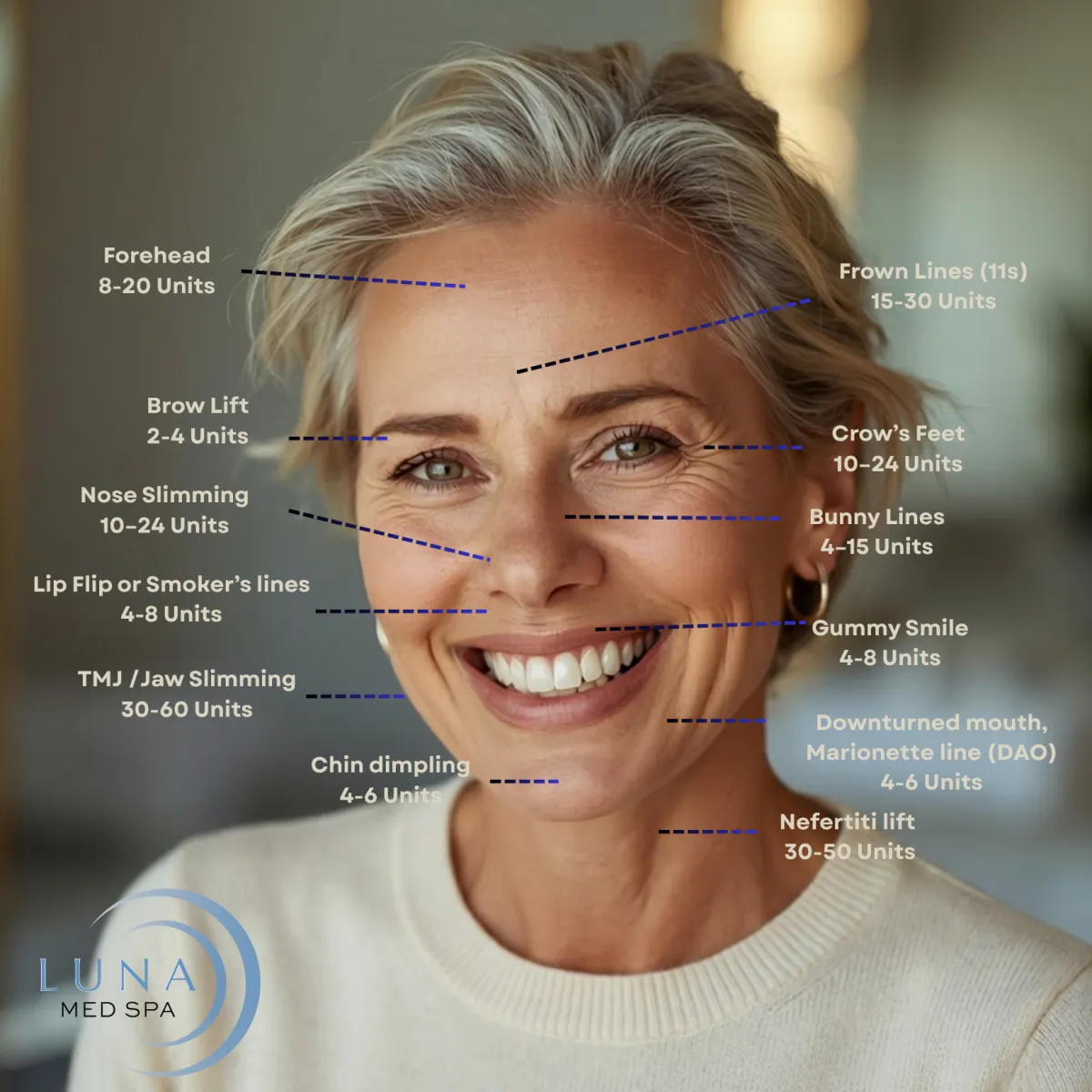 How Much Does a Botox Treatment Cost?