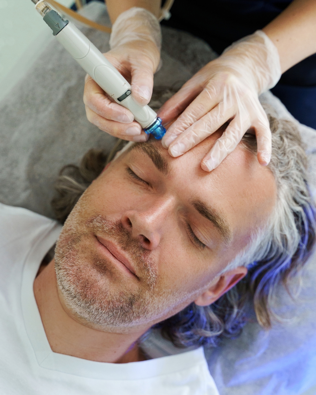Hydradermabrasion at Luna Med Spa Burlington